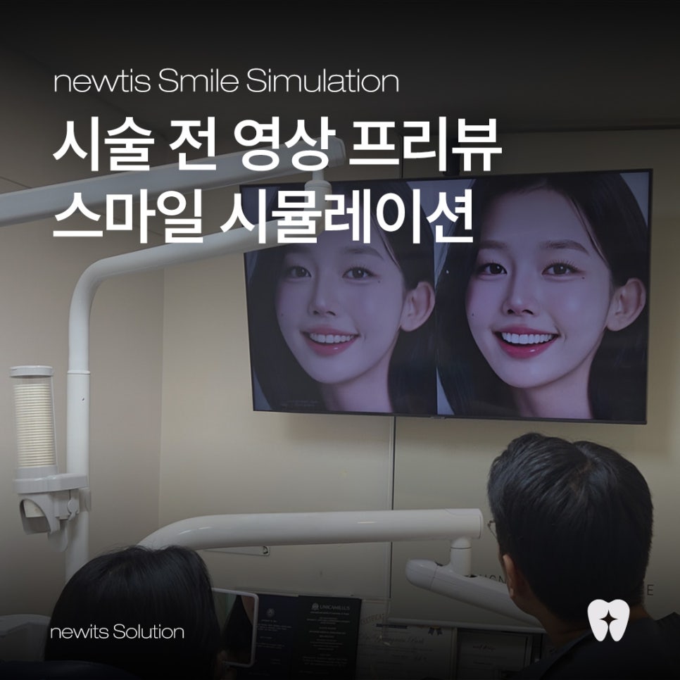 뉴티스 스마일 시뮬레이션 - 시술 전 영상으로 미리 확인하는 내 모습! / 강남레옹치과 관련 이미지 1