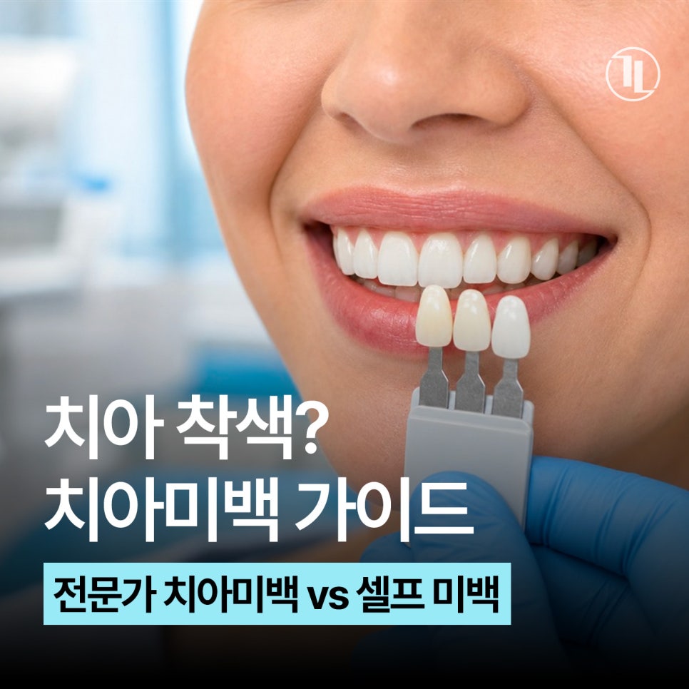 치아미백 가이드 / 비용과 효과, 셀프 미백 비교까지 / 강남레옹치과 관련 이미지 1