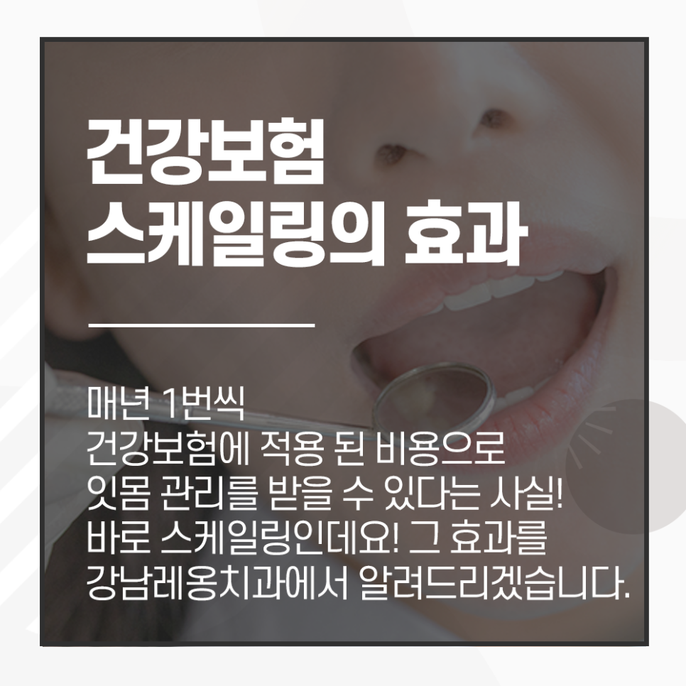 건강보험 적용 되는 치아 스케일링 효과 알고 받으면 더 좋아요! 관련 이미지 1
