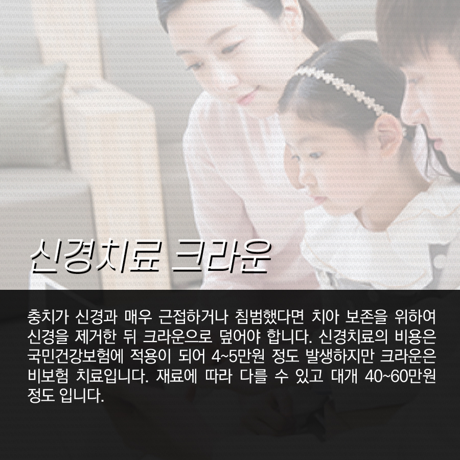 충치치료 비용이 왜 각각 다르고, 종류는 어떤 게 있을까? 관련 이미지 4