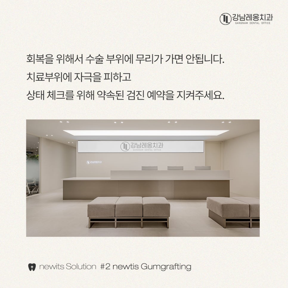 뉴티스 잇몸이식✨ 잇몸퇴축, 치아뿌리를 보호하고 심미적 개선 / 강남레옹치과 관련 이미지 5