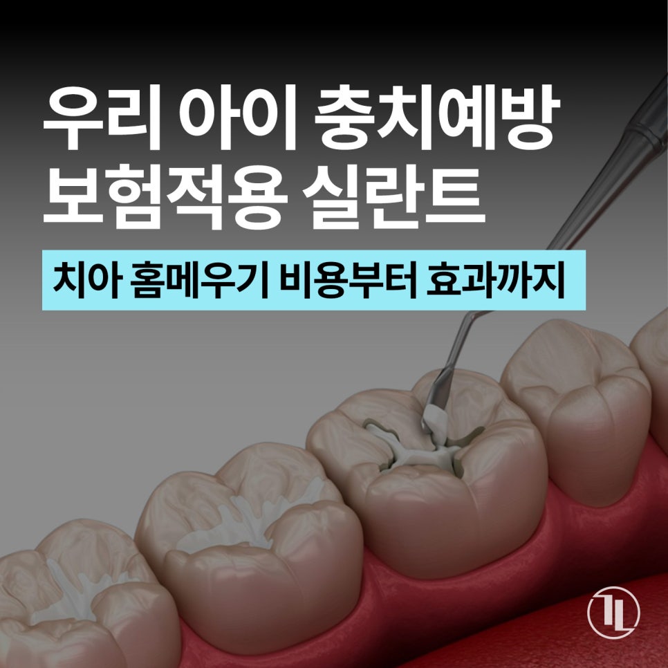 아이 충치 예방 치아 홈메우기 총정리! 실란트 시기&middot;비용(보험적용)&middot;효과 완벽 가이드 / 강남레옹치과 관련 이미지 1