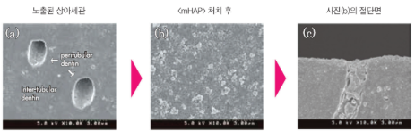 치아성분 치아영양제 아파프로로 약해진 치아관리! / 강남레옹치과 관련 이미지 6