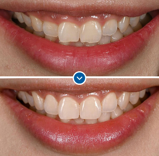 박영민 원장님의 뉴티스 앞니치료 세미나 in LA🤓 관련 이미지 4