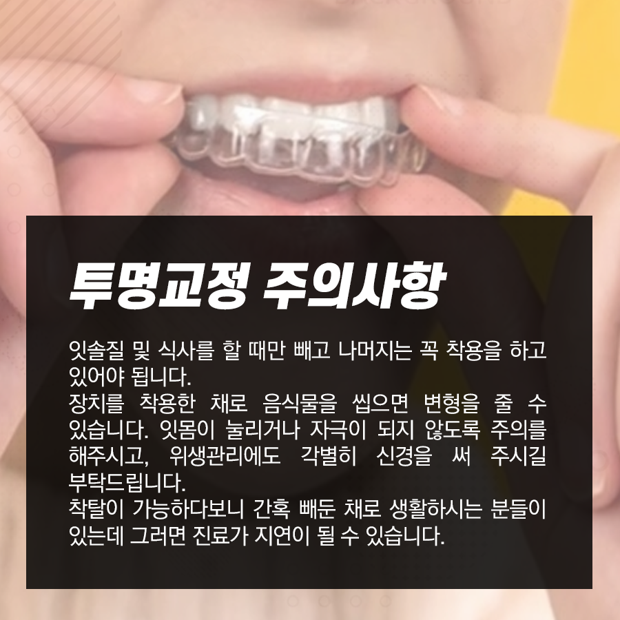 강남역 치과 투명교정 주의사항, 치료과정 및 방법 관련 이미지 4