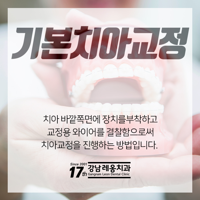 강남 치아교정치과 검증된 방법으로 만족도 업!! 관련 이미지 3