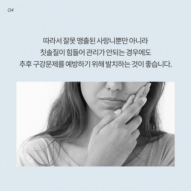 사랑니 4개 다 꼭 뽑아야 될까요? 발치 달인 강남레옹치과의 답변~ 관련 이미지 5