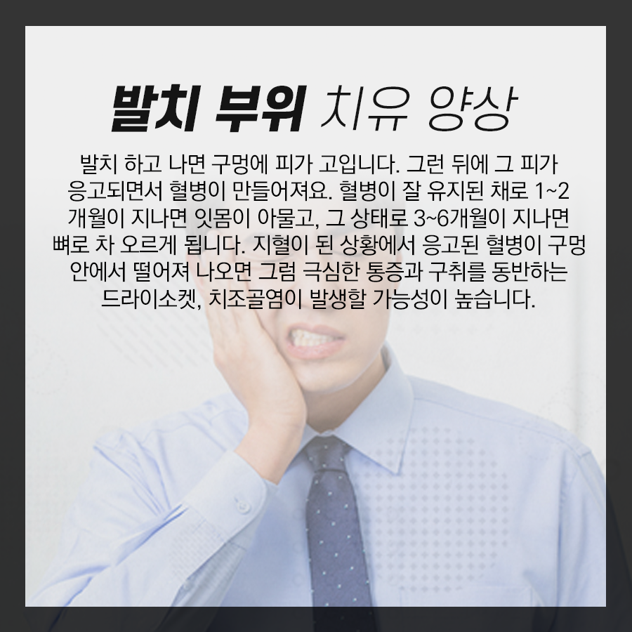 사랑니 발치 후 구멍 제대로 치유되려면 음식물 안 끼게 관리! 관련 이미지 4