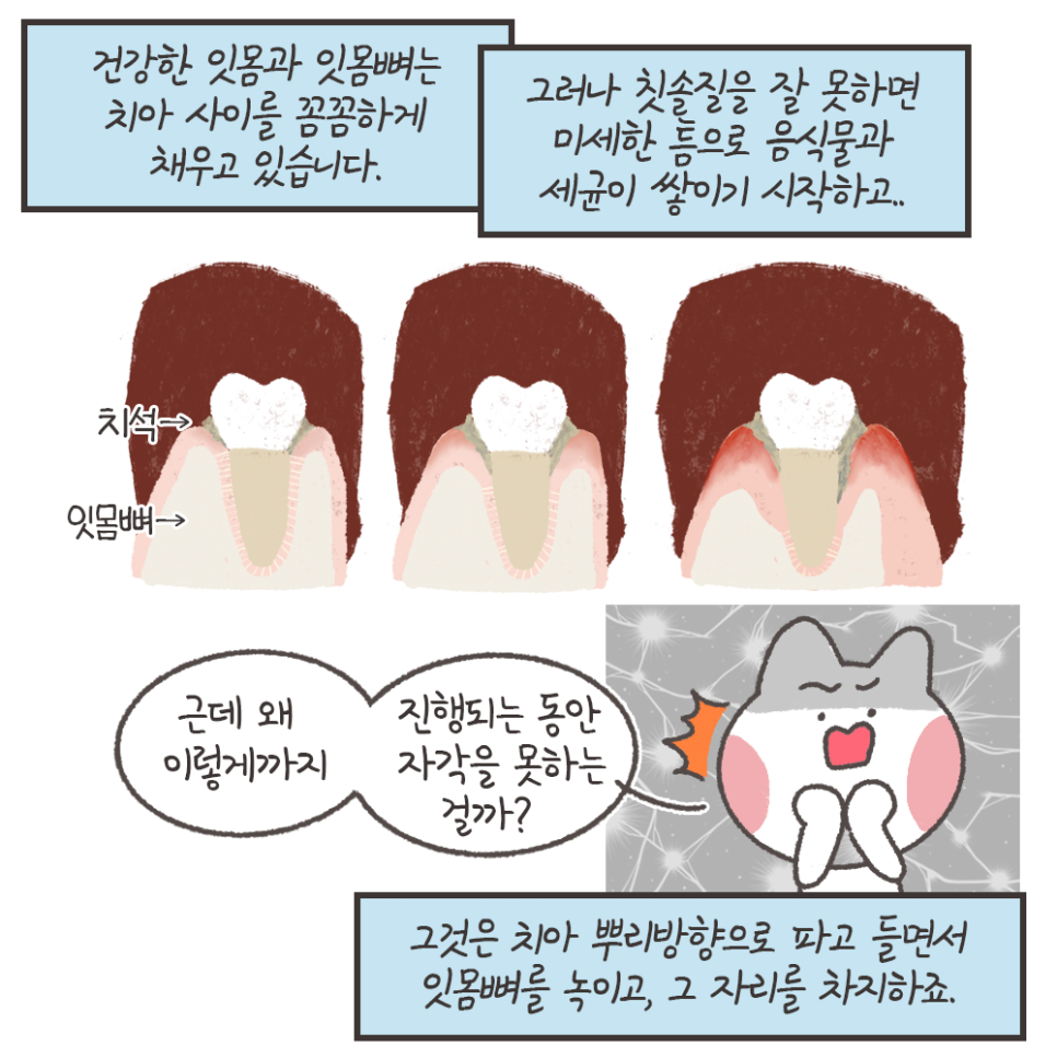 냐폴레옹 치과툰) 스케일링 후 이가 시린 이유가, 치아를 갈아서라고?? 관련 이미지 8