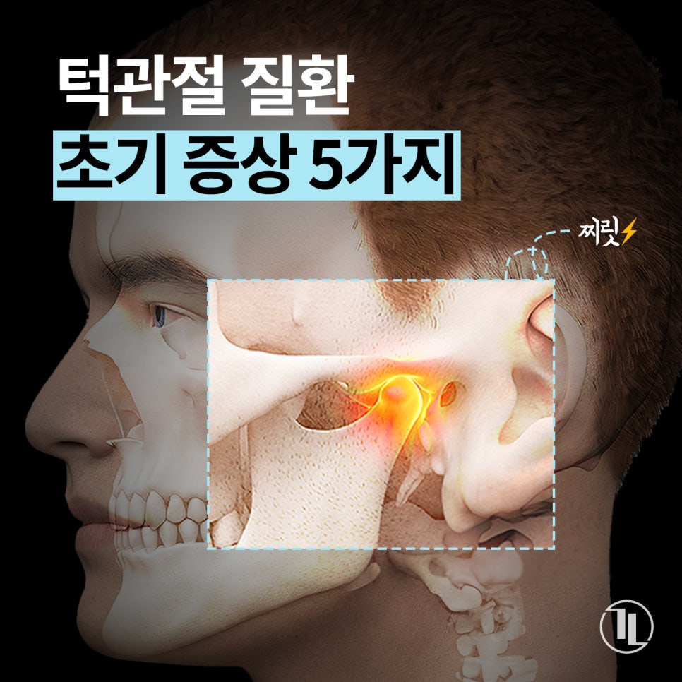 턱관절 질환 초기 증상 5가지로 알아보는 턱관절 통증 원인과 치료 / 강남레옹치과 관련 이미지 1