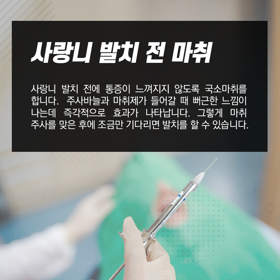 사랑니발치 통증 어떻게 줄일 수 있을까? 관련 이미지 2