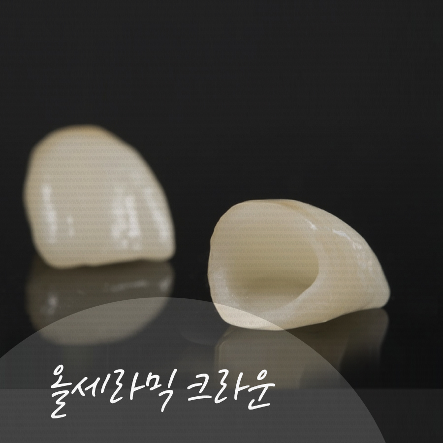 크라운치료 비용, 각자 특징과 장단점이 달라요. 관련 이미지 4