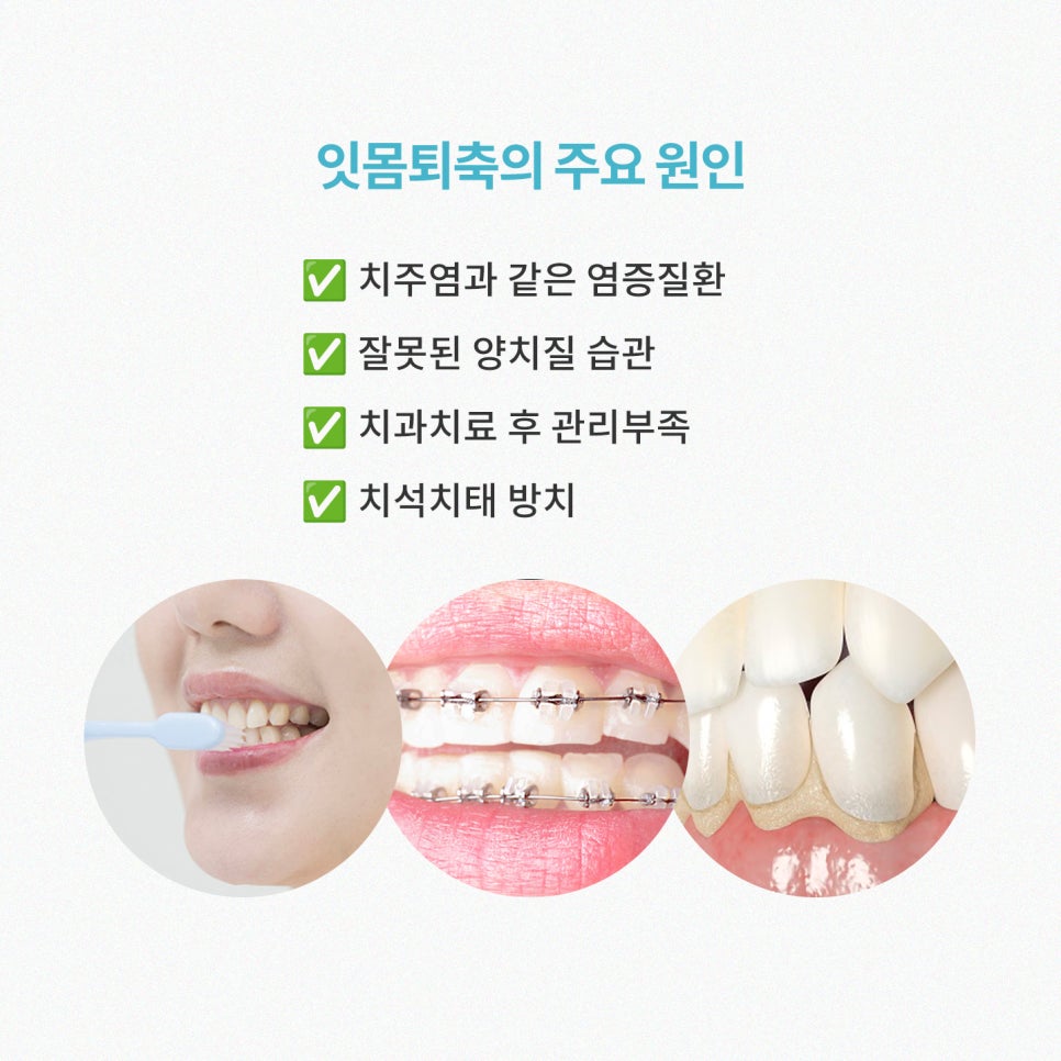 Gum Recession: Can It Expose the Tooth Roots? Before and After Gum Grafting! / Gangnam Leon Dental Clinic image 2