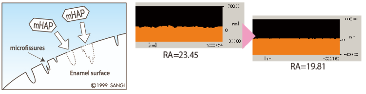 치아성분 치아영양제 아파프로로 약해진 치아관리! / 강남레옹치과 관련 이미지 4