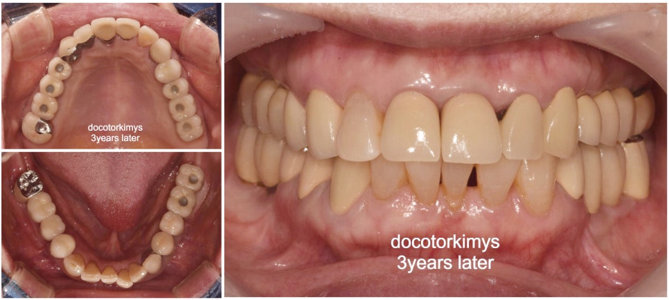 레옹의 원장님은 해외에서 러브콜~ 관련 이미지 2