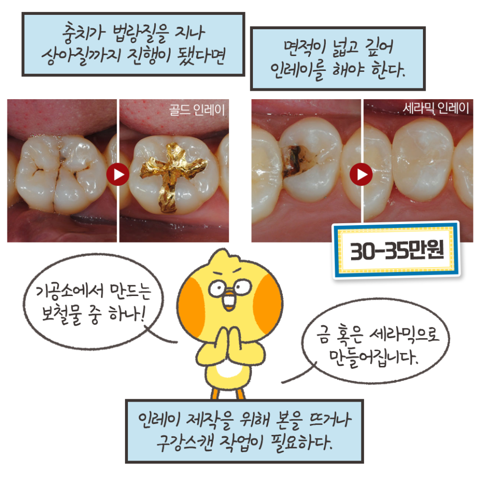 냐폴레옹 치과툰) 사람마다 다른 충치치료 비용 관련 이미지 8