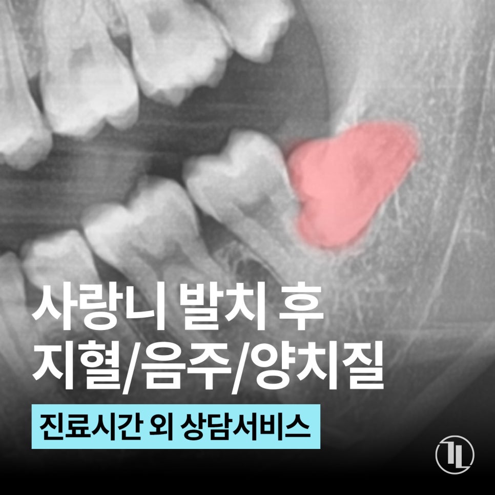 사랑니 발치 후 지혈, 음주, 양치 주의사항 / 강남레옹치과 관련 이미지 1