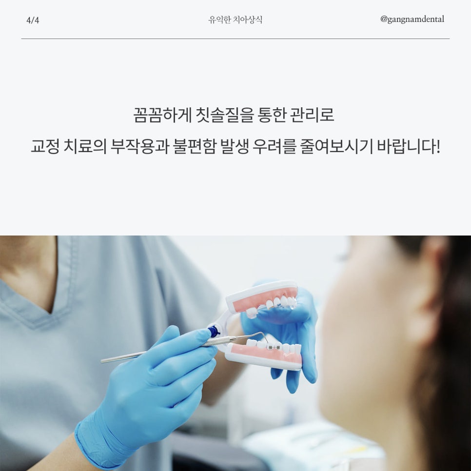 청소년 치아교정 관리의 중요성과 고정식 브라켓 교정&인비절라인 투명 치아 교정 양치하는 방법 관련 이미지 5