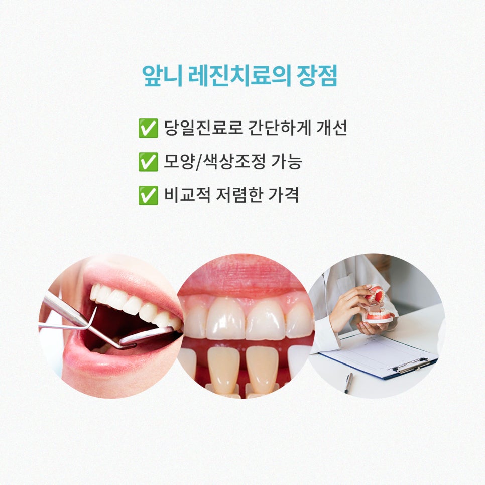 치아 손상없이 앞니 레진치료, 실제 후기 3가지! / 강남레옹치과 관련 이미지 11