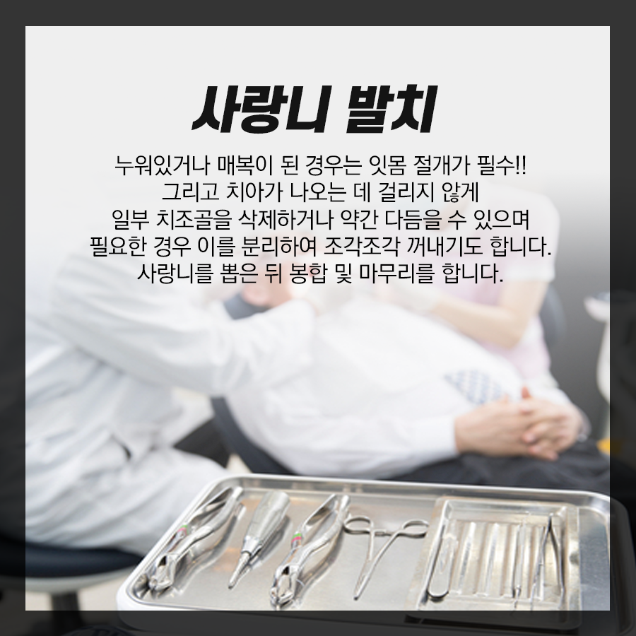 누운 사랑니 발치 과정, 매복 된 상태라면 검사 후 이런 순서로 뽑아요 관련 이미지 5