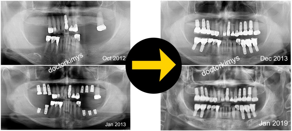 레옹의 원장님은 해외에서 러브콜~ 관련 이미지 3