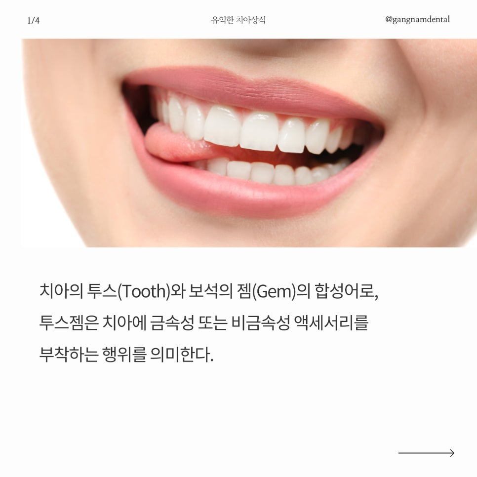 반짝반짝한 치아 ✨ 관련 이미지 3