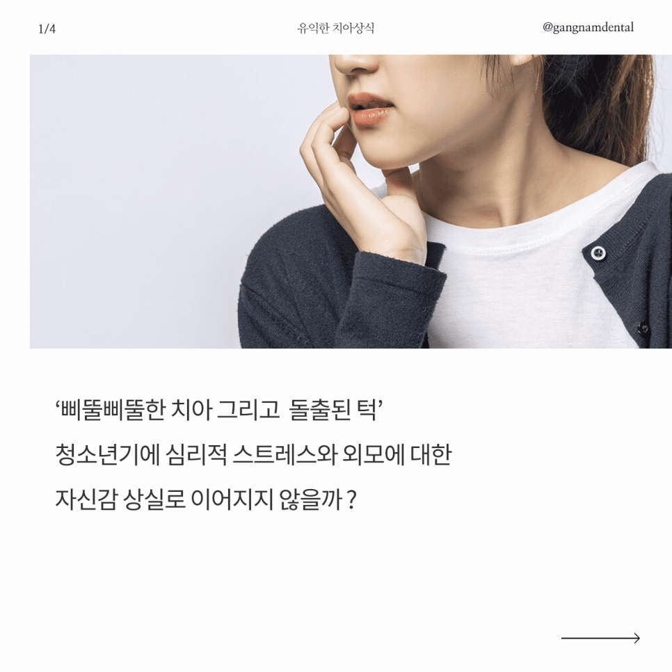 소아 청소년 치아교정의 필요성과 관련 이미지 2