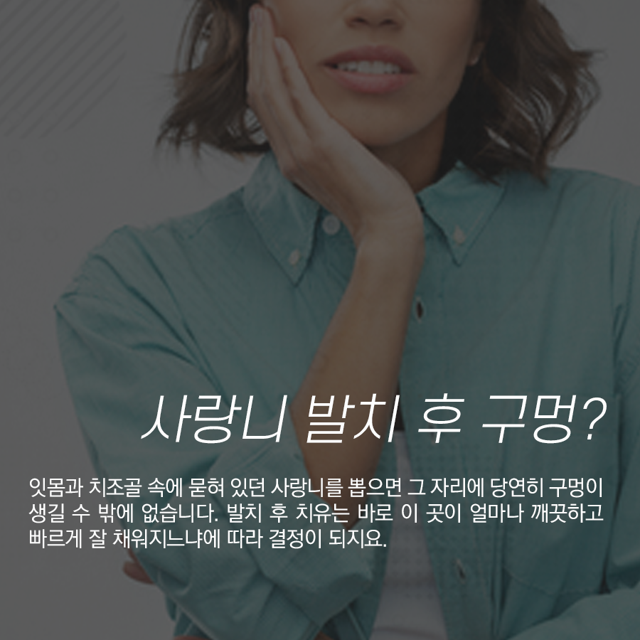 사랑니 발치 후 구멍 제대로 치유되려면 음식물 안 끼게 관리! 관련 이미지 2