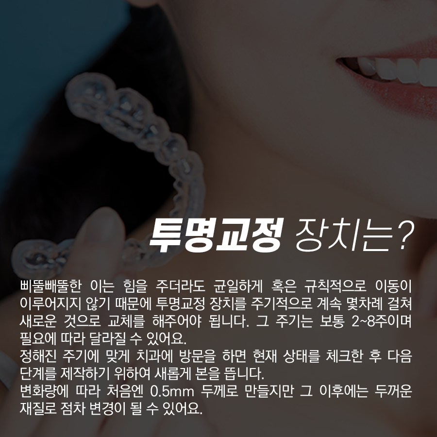 강남역 치과 투명교정 주의사항, 치료과정 및 방법 관련 이미지 2