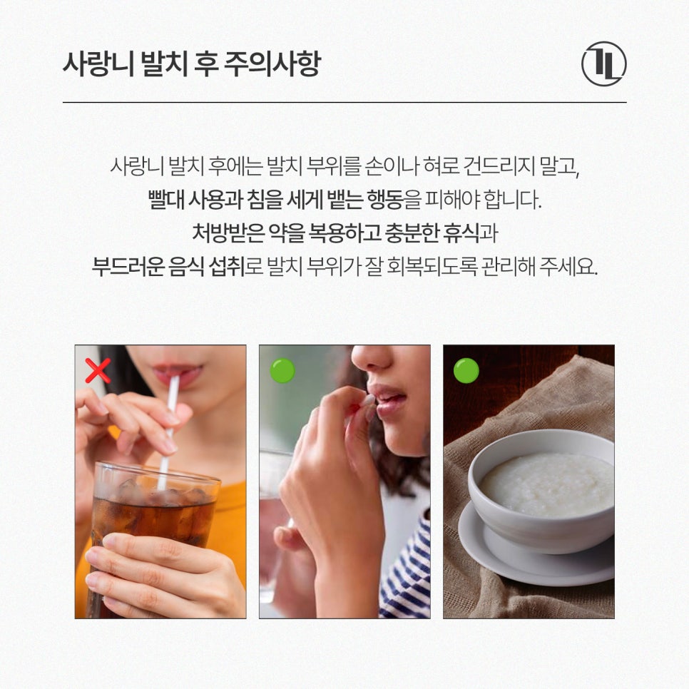 사랑니 발치 후 술&담배 언제 가능? 사랑니 회복 가이드🔖/ 강남레옹치과 관련 이미지 9
