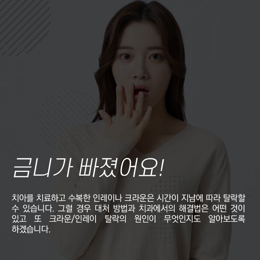 강남역치과 금니 빠짐 원인!? 크라운 / 인레이 탈락 시 대처방법 관련 이미지 2