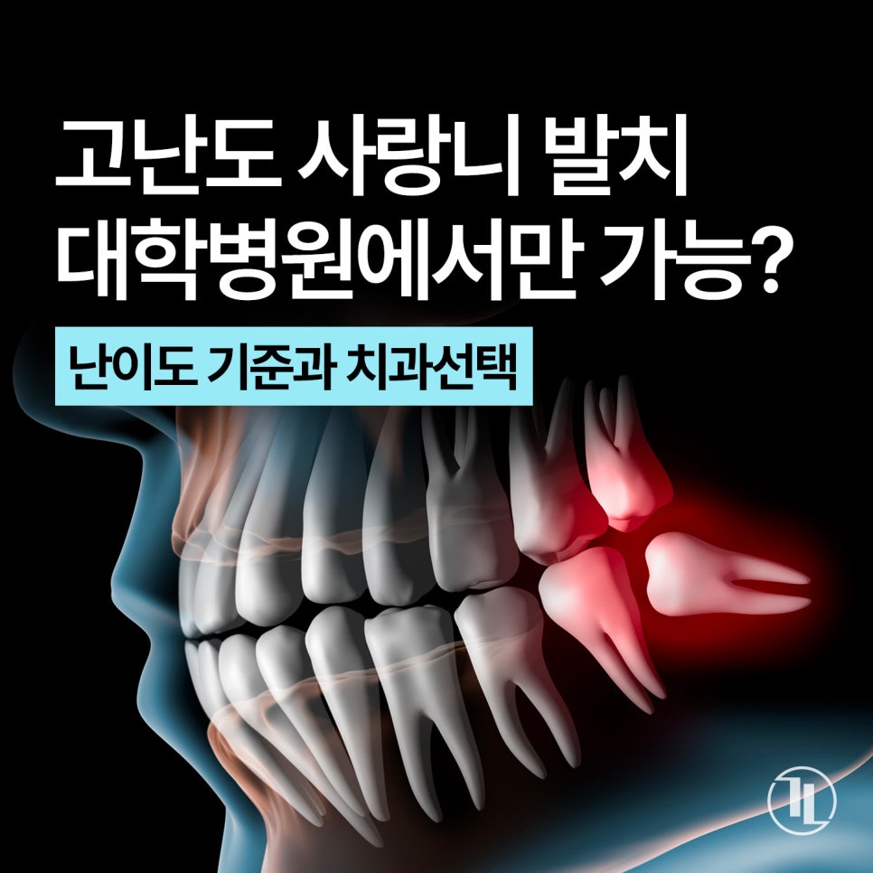 사랑니 발치, 왜 어떤 경우에 대학병원을 권유할까? / 강남레옹치과 관련 이미지 1