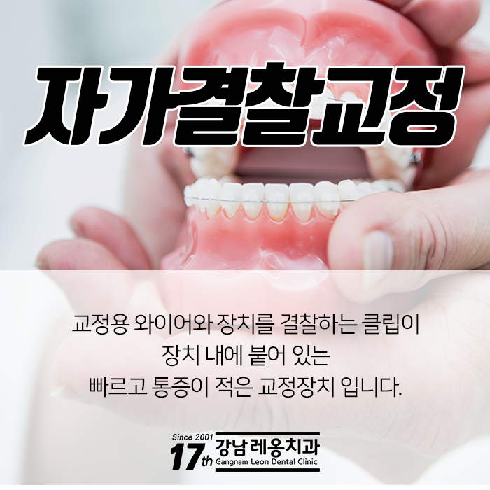 강남 치아교정치과 검증된 방법으로 만족도 업!! 관련 이미지 5