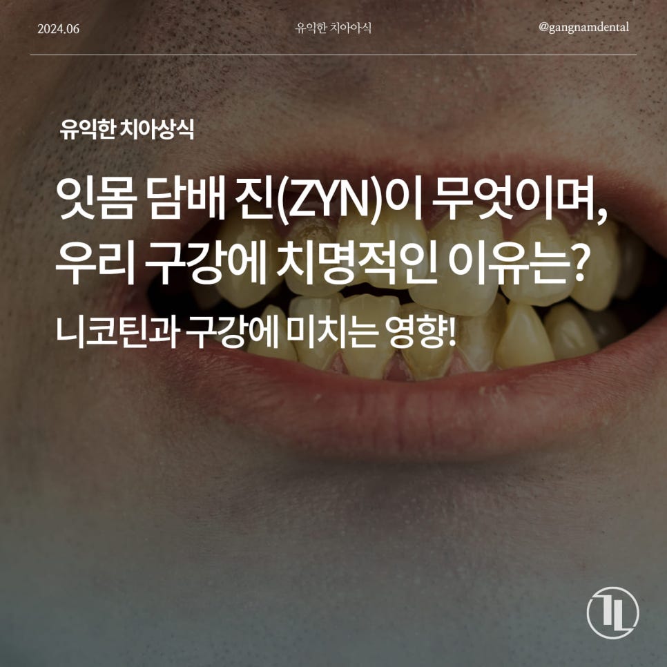 미국 MZ세대에서 유행 중인 잇몸 담배 진(ZYN)이 무엇이며, 우리 구강에 치명적인 이유는? / 니코틴이 우리 치아&잇몸에 미치는 영향은? 관련 이미지 1