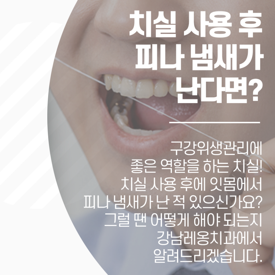 치실 사용 후 잇몸에서 피 나거나 냄새 난다면 관련 이미지 1