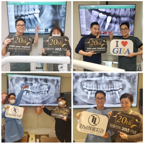 Full-Mouth Implant Treatment Case for Extensive Tooth Loss / Gangnam Leon Dental Clinic image 7