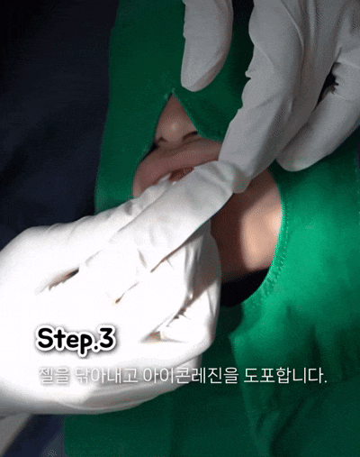 우리 아이 앞니에 하얀 반점! 소아 충치 시작의 신호? / 강남레옹치과 관련 이미지 6