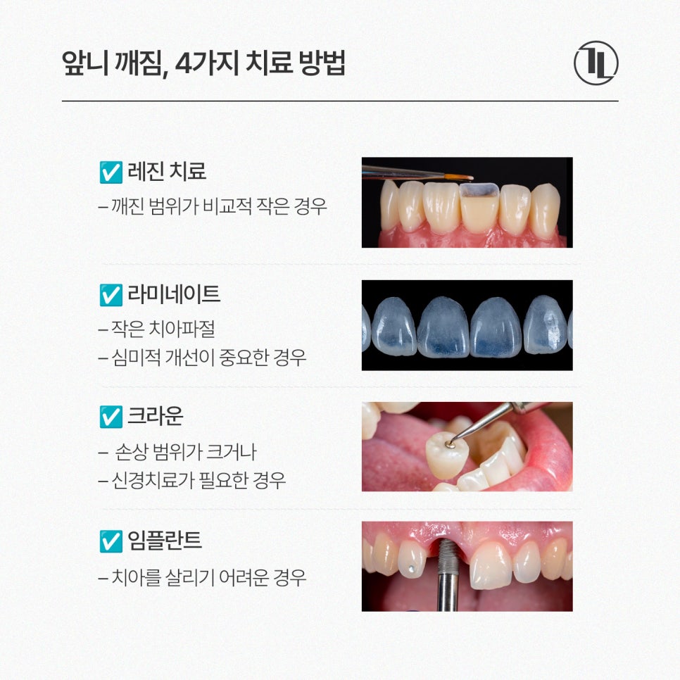 앞니가 깨졌다면?! 4가지 치료방법 비교! / 레진을 선택한 이유 / 강남레옹치과 관련 이미지 3