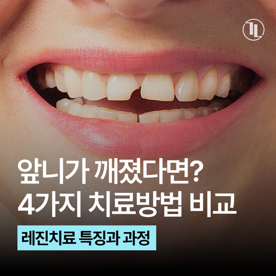 앞니가 깨졌다면?! 4가지 치료방법 비교! / 레진을 선택한 이유 / 강남레옹치과 관련 이미지 1