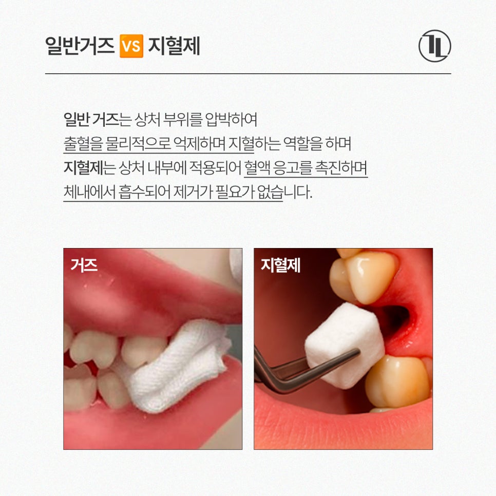 Is a Hemostatic Agent Really Necessary for Wisdom Tooth Extraction? Hemostatic Agent Usage Criteria, Insurance Coverage, and Cost / Gangnam Leon Dental Clinic image 2