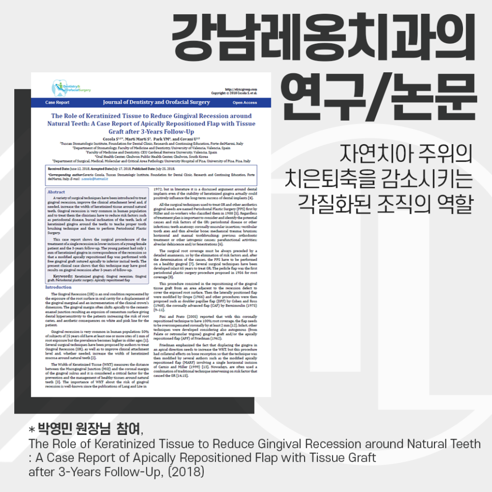 박영민 원장님의 논문! 치은이식 후 자연치아 주위 잇몸퇴축 감소에 관한 연구 관련 이미지 1