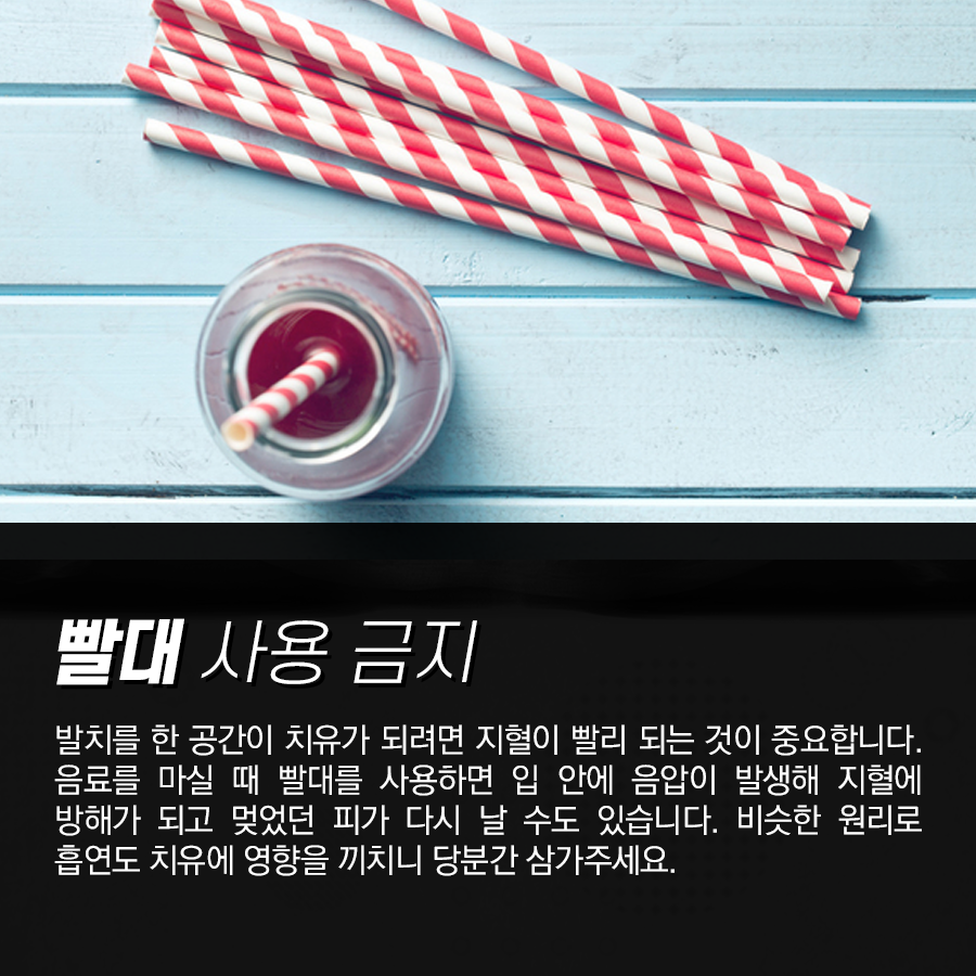 사랑니 발치 후 식사 요령, 언제부터 어떤 음식을 먹어야 될까? 관련 이미지 5