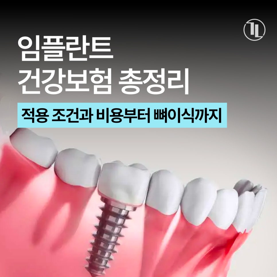 A Complete Guide to National Health Insurance Coverage for Implants / Out-of-Pocket Costs, Number Covered, Treatment Period, Bone Grafting, and FAQs / Gangnam Leon Dental Clinic image 1