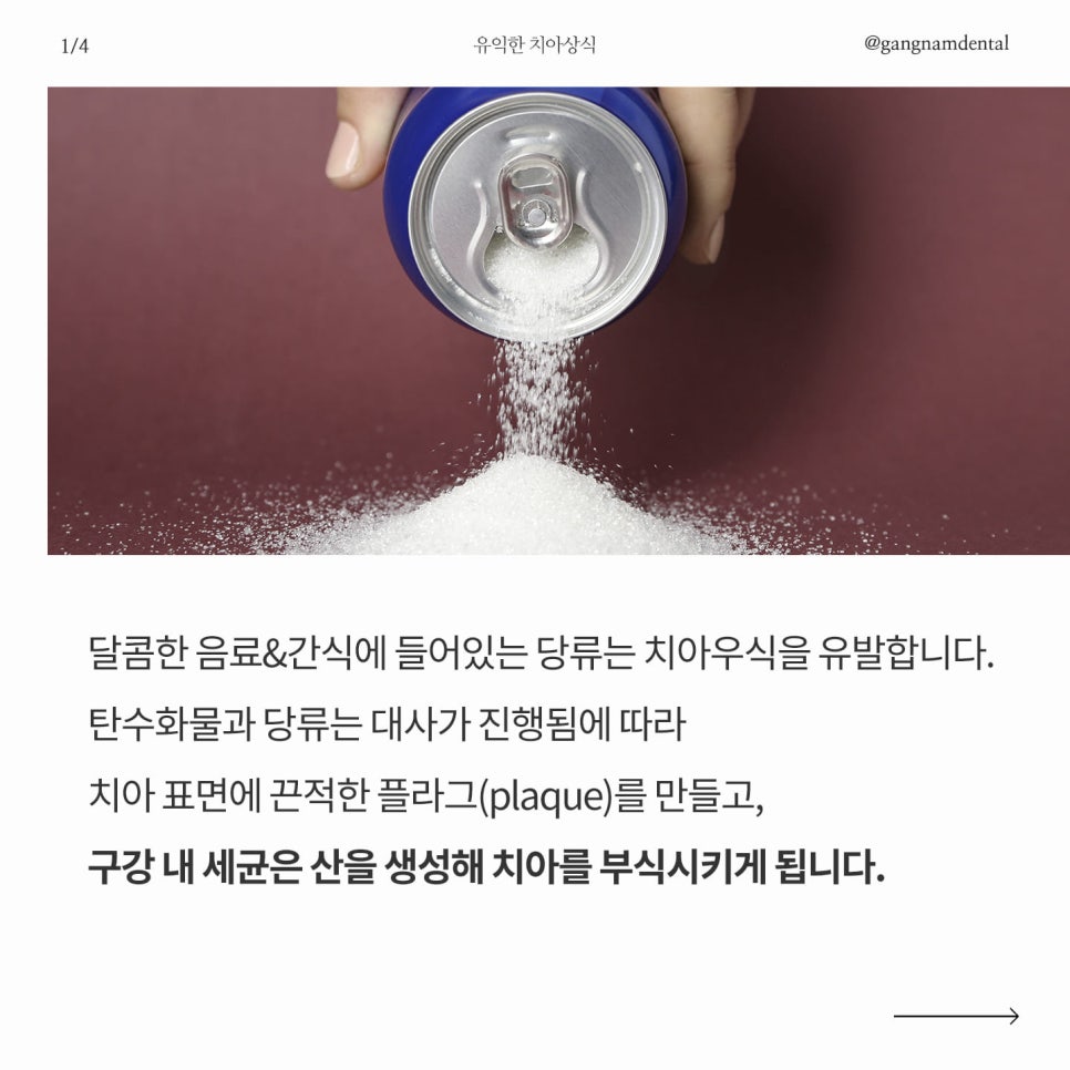 여름철 치아 관리는 어떻게 해야할까요? / 상아질지각과민증 초기 증상 관련 이미지 2