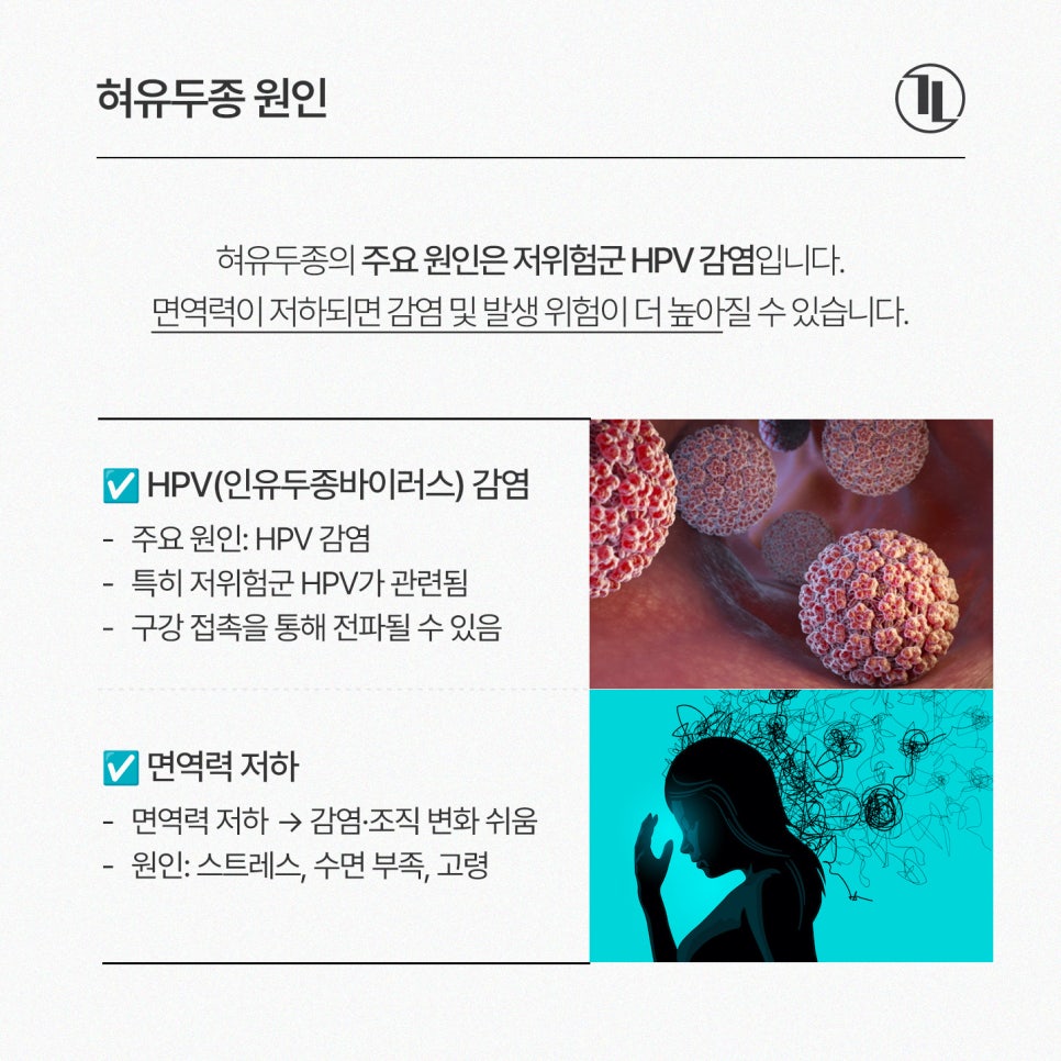 Small Bump (Growth) on the Tongue: Symptoms and Causes of Tongue Papilloma, and the Removal Process / Gangnam Leon Dental Clinic image 3