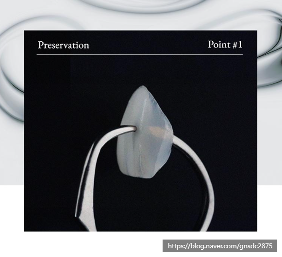 치아파절 개선방법, 뉴티스라미✨ / 강남레옹치과 관련 이미지 5