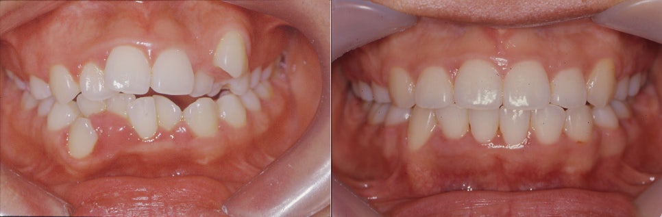 강남 치아교정치과 검증된 방법으로 만족도 업!! 관련 이미지 2