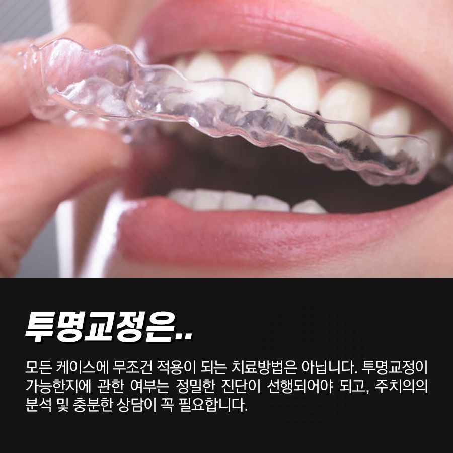 강남역 치과 투명교정 주의사항, 치료과정 및 방법 관련 이미지 3