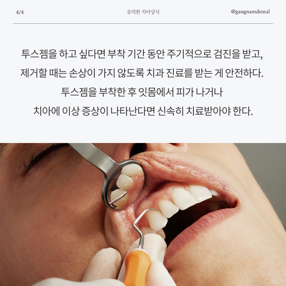 반짝반짝한 치아 ✨ 관련 이미지 7