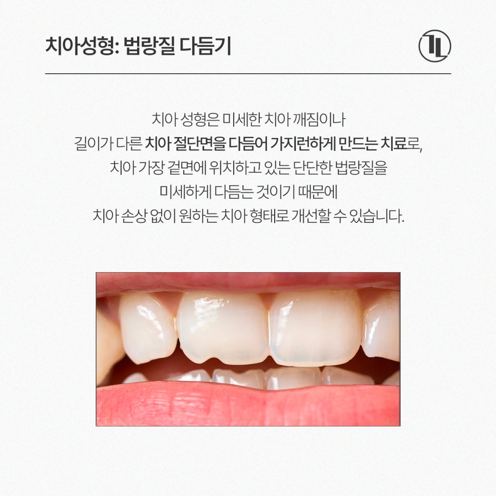 살짝 깨진 앞니 끝, 치아성형으로 고르게 다듬기 / 강남레옹치과 관련 이미지 2